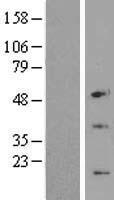 C6ORF173 (CENPW) Human Over-expression Lysate
