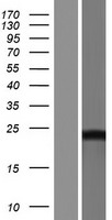 DCTD Human Over-expression Lysate