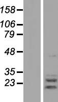 AGPAT2 Human Over-expression Lysate