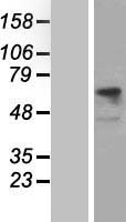 CD98 (SLC3A2) Human Over-expression Lysate