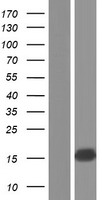 Sterol carrier protein 2 (SCP2) Human Over-expression Lysate