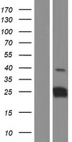 CT45A1 Human Over-expression Lysate