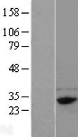 FAM78B Human Over-expression Lysate