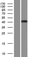 RCCD1 Human Over-expression Lysate