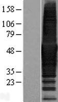 CORO1B Human Over-expression Lysate