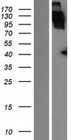 ApoER2 (LRP8) Human Over-expression Lysate