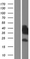 SH3BP5 Human Over-expression Lysate