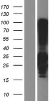 C4BPB Human Over-expression Lysate