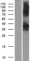 YDJC Human Over-expression Lysate