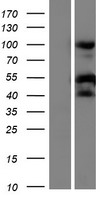 RPS21 Human Over-expression Lysate