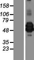 CHI3L2 Human Over-expression Lysate