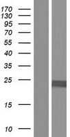 Casein (CSN1S1) Human Over-expression Lysate
