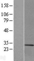 Myelin Basic Protein (MBP) Human Over-expression Lysate