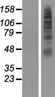 SLC2A11 Human Over-expression Lysate