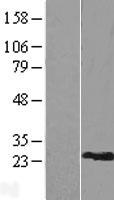 RPL9 Human Over-expression Lysate