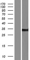 ZNF197 Human Over-expression Lysate