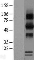 RNASE12 Human Over-expression Lysate