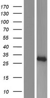 ACTL10 Human Over-expression Lysate