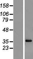 RPL6 Human Over-expression Lysate