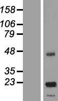 ASPDH Human Over-expression Lysate