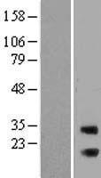 RAB3IP Human Over-expression Lysate