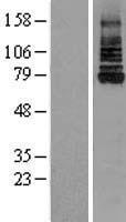 IRAK (IRAK1) Human Over-expression Lysate