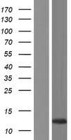 CLLU1-AS1 Human Over-expression Lysate