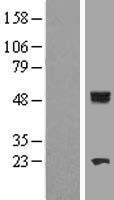 CYP11B1 Human Over-expression Lysate