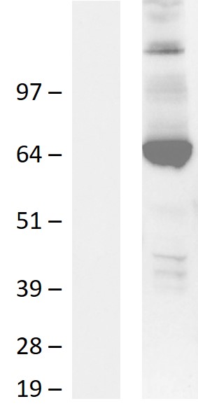 RFX5 Human Over-expression Lysate