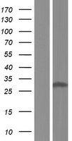 NQO1 Human Over-expression Lysate