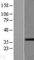 VEGFA Human Over-expression Lysate