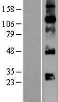 VEGFA Human Over-expression Lysate