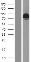 Artemis (DCLRE1C) Human Over-expression Lysate