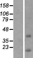 CCDC153 Human Over-expression Lysate