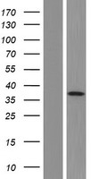 MYO19 Human Over-expression Lysate