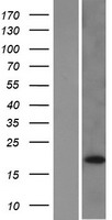 DUSP28 Human Over-expression Lysate