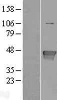 Glutamine Synthetase (GLUL) Human Over-expression Lysate