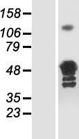 Glutamine Synthetase (GLUL) Human Over-expression Lysate