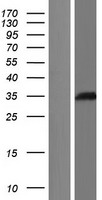 LCMT1 Human Over-expression Lysate