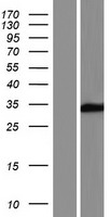 SULT6B1 Human Over-expression Lysate