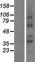 RCE1 Human Over-expression Lysate