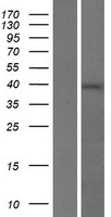 RGS7BP Human Over-expression Lysate