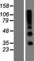 RSPO4 Human Over-expression Lysate