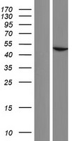 ACTBL2 Human Over-expression Lysate