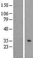RAB40AL Human Over-expression Lysate