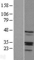 RIBC1 Human Over-expression Lysate
