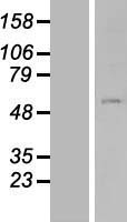 NEK10 Human Over-expression Lysate