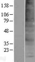 TMEM150A Human Over-expression Lysate