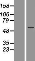 Sec8 (EXOC4) Human Over-expression Lysate