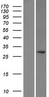 ACTH (POMC) Human Over-expression Lysate